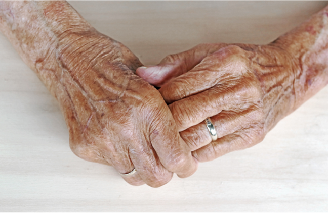 Dementia Life Expectancy: Improving the Quality of Life for You and Your Loved One